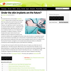 Under the skin implants are the future?