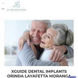 XGuide Dental Implants Orinda Layafetta Moranga (Lamorinda)