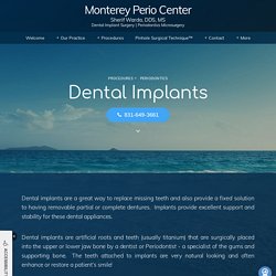 Find Best Dental Implants Monterey CA