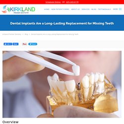 Dental Implants Are a Long-Lasting Replacement for Missing Teeth: Kirkland Premier Dentistry: General Dentistry