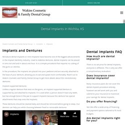 Dental Implants in Wichita, KS - Wichita, KS: Wakim Cosmetic and Family Dental Group