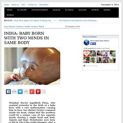 India: Baby Born With Two Minds in Same Body