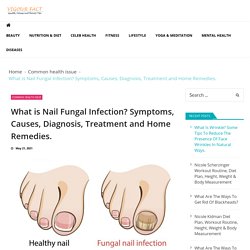 What is Nail Fungal Infection? Symptoms, Causes, Diagnosis, Treatment and Home Remedies. - Vigourfact
