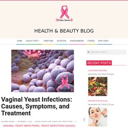 Vaginal Yeast Infections: Causes, Symptoms, and Treatment