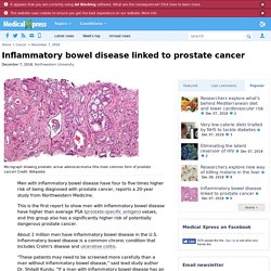 Inflammatory bowel disease linked to prostate cancer