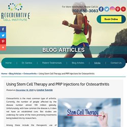 Using Stem Cell Therapy and PRP Injections for Osteoarthritis