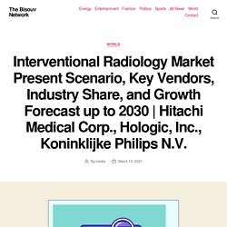 Interventional Radiology Market Present Scenario, Key Vendors, Industry Share, and Growth Forecast up to 2030