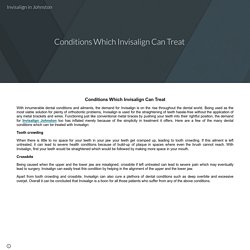 Conditions Which Invisalign Can Treat