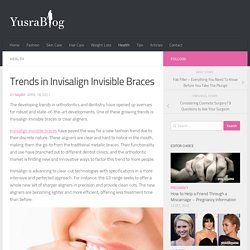 Trends in Invisalign Invisible Braces - YusraBlog.com