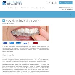 How does Invisalign work? - Springdale Dental Centre