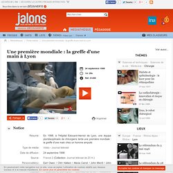 Une première mondiale : la greffe d'une main à Lyon - Jalons pour l'histoire du temps présent