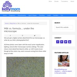 Milk vs. formula… under the microscope