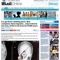 Man had knife buried in face for four years: I've got these stabbing pains