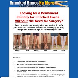 Knocked Knees No More - How to Straighten Your Legs Without Surgery!