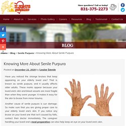 Knowing More About Senile Purpura