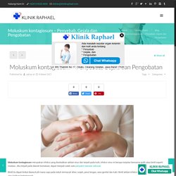 Moluskum kontagiosum - Penyebab, Gejala dan Pengobatan