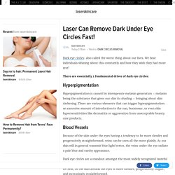 Laser Can Remove Dark Under Eye Circles Fast!