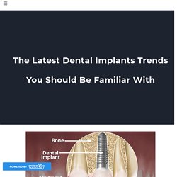 The Latest Dental Implants Trends You Should Be Familiar With