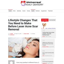 Lifestyle Changes That You Need to Make Before Laser Acne Scar Removal – Universal Family Dentistry