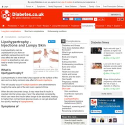 Lipohypertrophy - Injections and Lumpy Skin