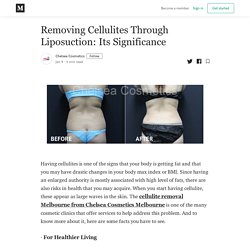 Removing Cellulites Through Liposuction: Its Significance