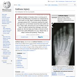 Lisfranc injury - Wikipedia