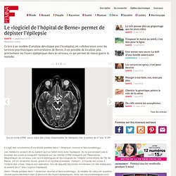 Le «logiciel de l'hôpital de Berne» permet de dépister l'épilepsie