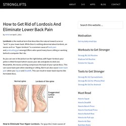 Lordosis: Why it Causes Lower Back Pain &amp; How to Fix it