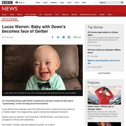 Lucas Warren: Baby with Down's becomes face of Gerber