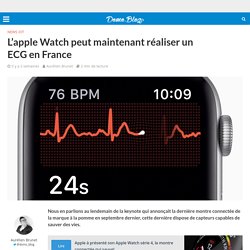 L'apple Watch peut maintenant réaliser un ECG en France -