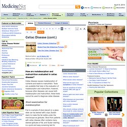 Celiac Disease Symptoms, Causes, Treatment - What if individuals don't respond to gluten free diet? on MedicineNet