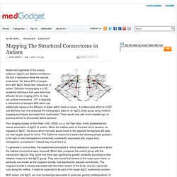 Mapping The Structural Connectome in Autism