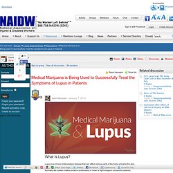 Medical Marijuana is Being Used to Successfully Treat the Symptoms of Lupus in Patients