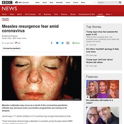 Measles resurgence fear amid coronavirus