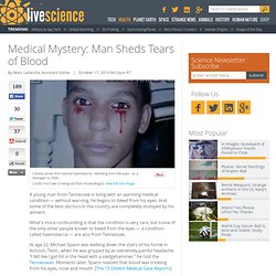 Medical Mystery: Man Sheds Tears of Blood