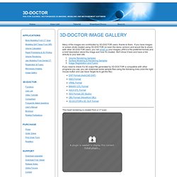 3D-DOCTOR, medical modeling, 3D medical imaging, image gallery