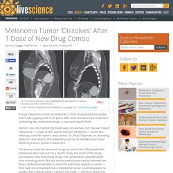 Melanoma Tumor 'Dissolves' After 1 Dose of New Drug Combo