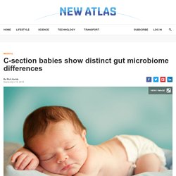 C-section babies show distinct gut microbiome differences