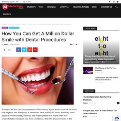 How You Can Get A Million Dollar Smile with Dental Procedures