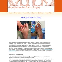 What to Expect From Bunion Surgery