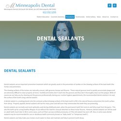Dental Sealants - Dental Implants - Minneapolis Dental, MNMinneapolis Dental