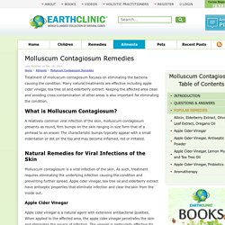 Molluscum Contagiosum Remedies
