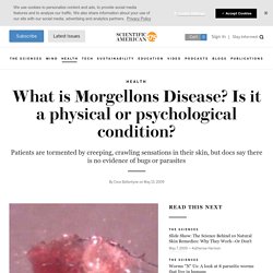 What is Morgellons Disease? Is it a physical or psychological condition?
