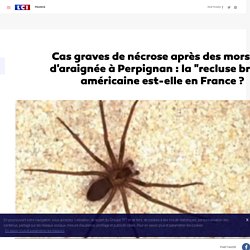 LCI 08/08/17 Cas graves de nécrose après des morsures d'araignée à Perpignan : la "recluse brune" américaine est-elle en France ?