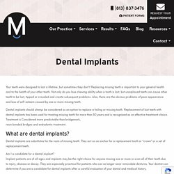 Full Mouth Dental Implants Tampa Bay FL