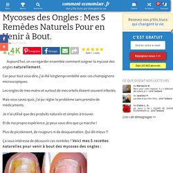 Mycoses des Ongles : Mes 5 Remèdes Naturels Pour en Venir à Bout.