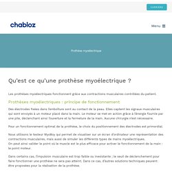 Prothèse myoélectrique - Chabloz orthopédie