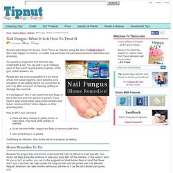 Nail Fungus: What It Is & How To Treat It