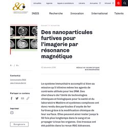 Des nanoparticules furtives pour l’imagerie par résonance magnétique
