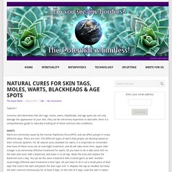 Natural Cures for Skin Tags, Moles, Warts, Blackheads & Age Spots